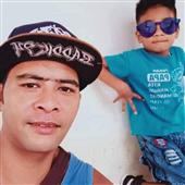 Mắt Bã