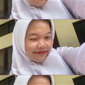 Mắt Bã